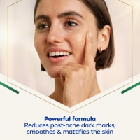 Nivea Luminous630 Post-Acne Marks Serum 30 ml