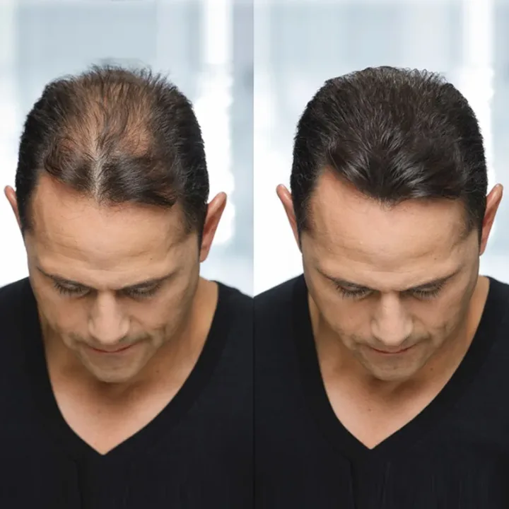 Toppik Hårfibrer Regular 12 g Mörkbrun Toppik