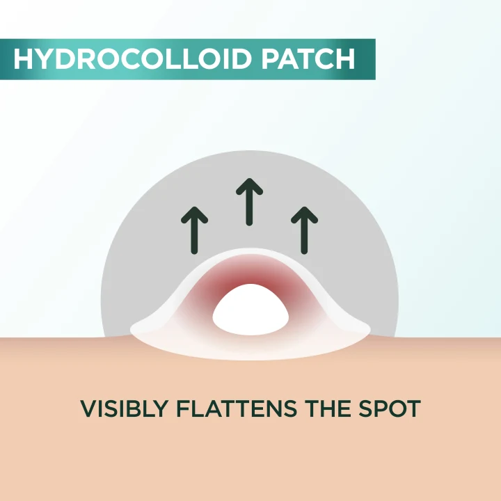 Garnier PureActive Pimple Patch For Impure Skin 22 st Garnier