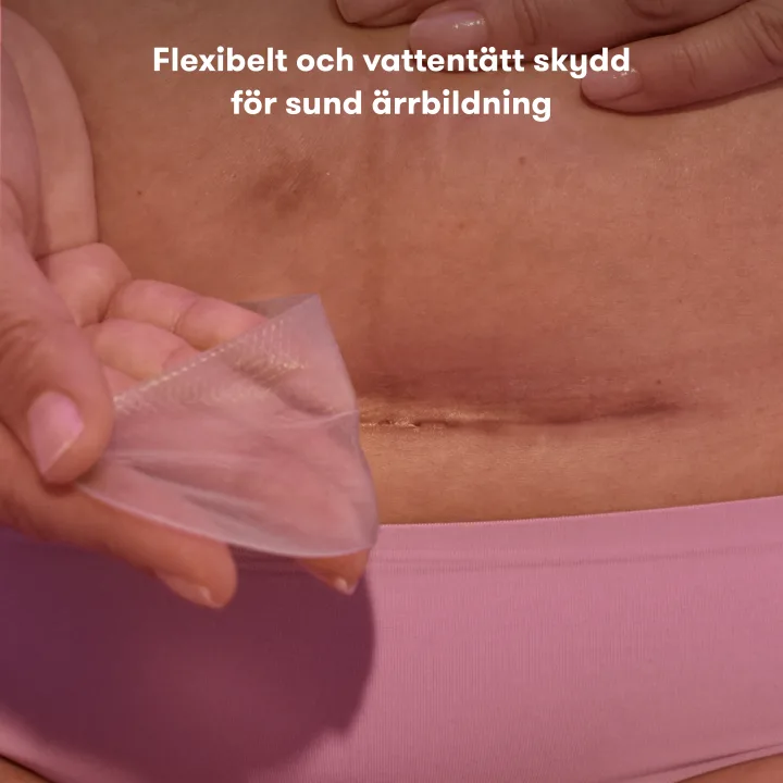 Frida Mom Ärrplåster i silikon för kejsarsnitt Frida Mom