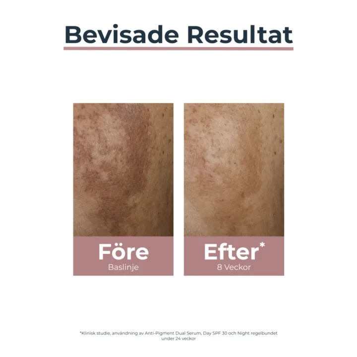 Eucerin Anti-Pigment Night Care 50 ml Eucerin