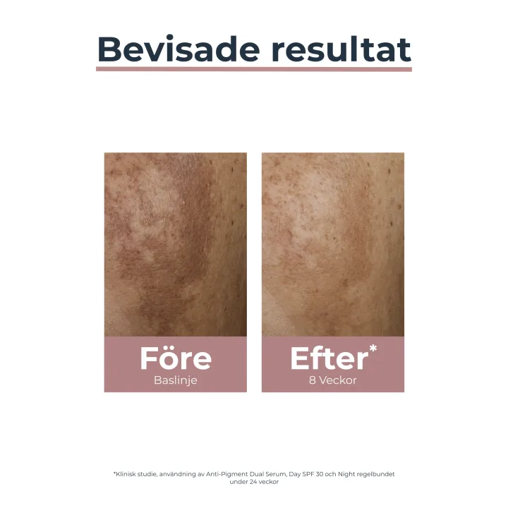 Eucerin ANTI-PIGMENT Day Care SPF 30, 50 ml Eucerin