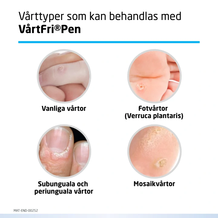Vårtfri Pen 3ml Vårtfri