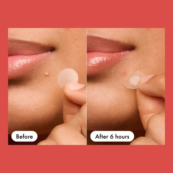 Hero Mighty Patch Original 24 st Hero