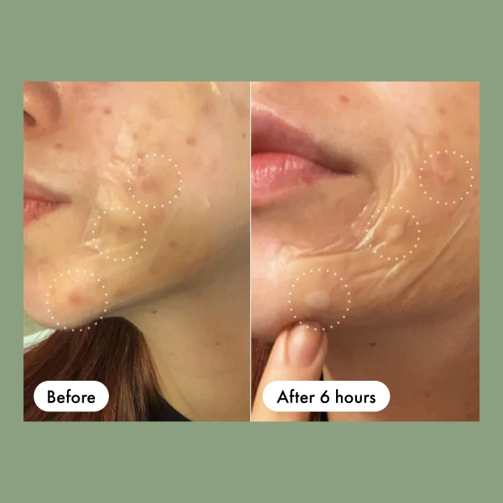 Hero Mighty Patch Surface 10 st Hero