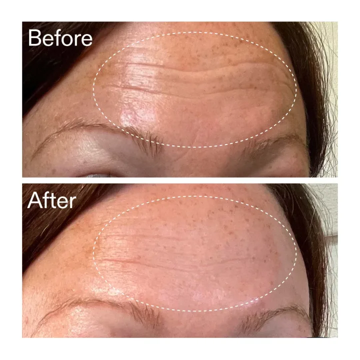 The Inkey List Starter Retinol Serum 30 ml The Inkey List 