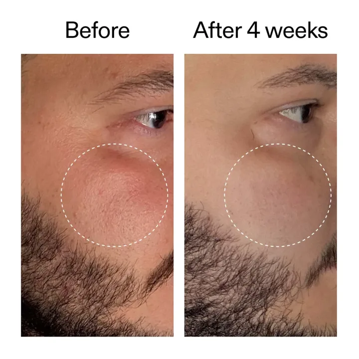 The Inkey List Starter Retinol Serum 30 ml The Inkey List 