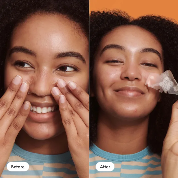 Hero Nose Patch 10 st Hero