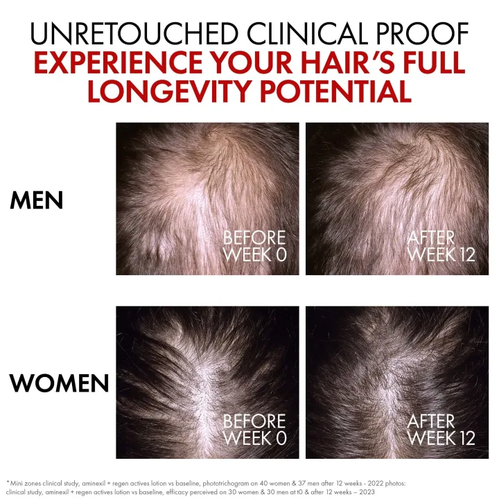 Vichy Dercos Aminexil R.E.G.E.N. Booster 90 ml Vichy