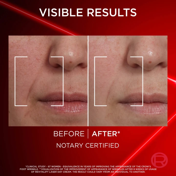 L'Oréal Paris Revitalift Laser Advance Anti-Ageing Care Day 50 ml L'Oréal Paris