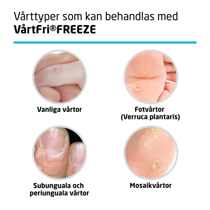 VårtFri Freeze Vårtmedel 21 ml Vårtfri