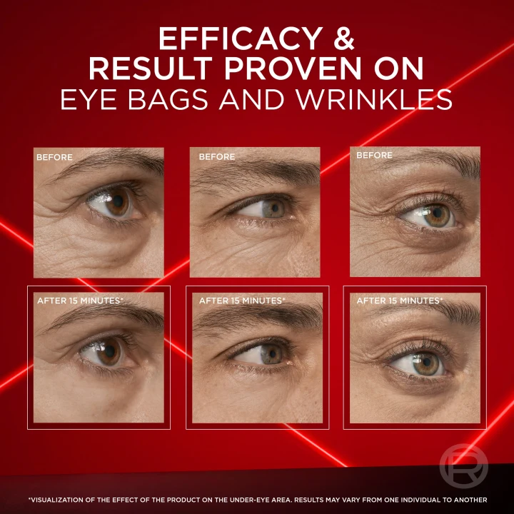 L'Oréal Paris Revitalift Laser Eye Bag Eraser 15 ml L'Oréal Paris