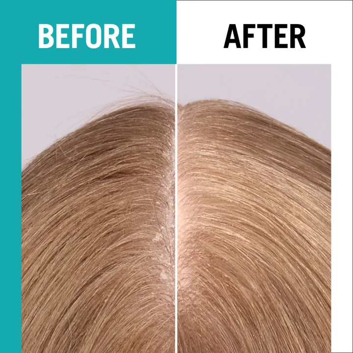 Schwarzkopf Gliss Scalp Balance Gentle Shampoo 200 ml Schwarzkopf