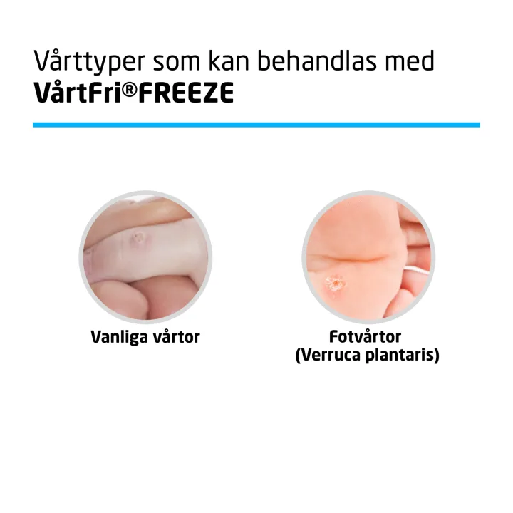 VårtFri Freeze Vårtmedel 21 ml Vårtfri