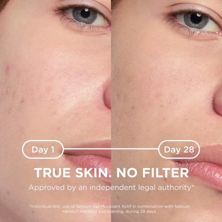 Bioderma Sebium Kerato+ 30 ml Bioderma
