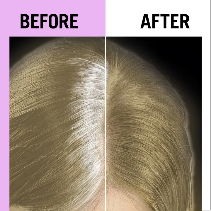Schwarzkopf Root Retoucher Dark Blonde Utväxtspray 120 ml Schwarzkopf