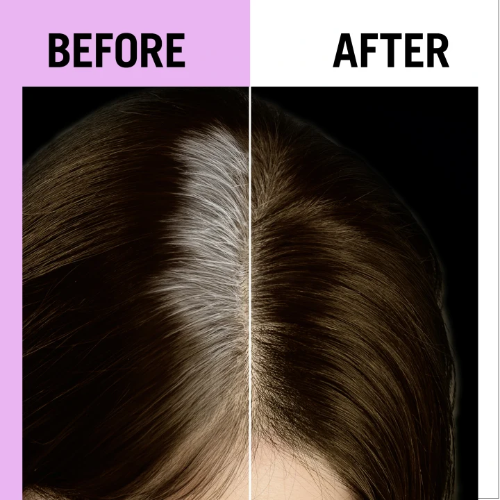 Schwarzkopf Root Retoucher Dark Brown Utväxtspray 120 ml Schwarzkopf