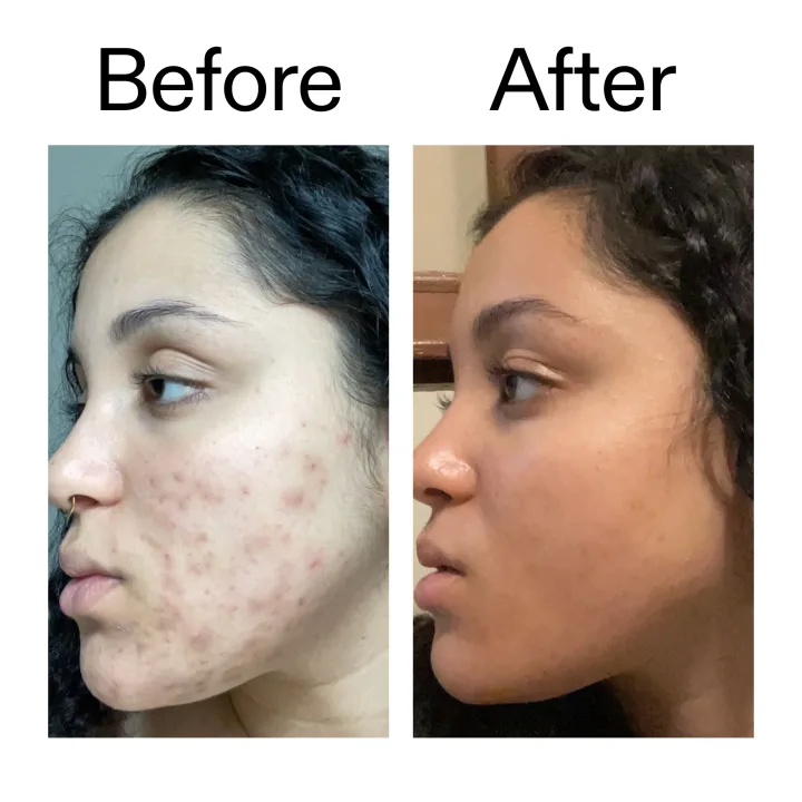 The Inkey List Tranexamic Acid Serum 30ml The Inkey List