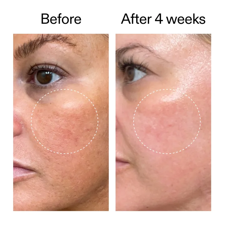 The Inkey List Starter Retinol Serum 30 ml The Inkey List