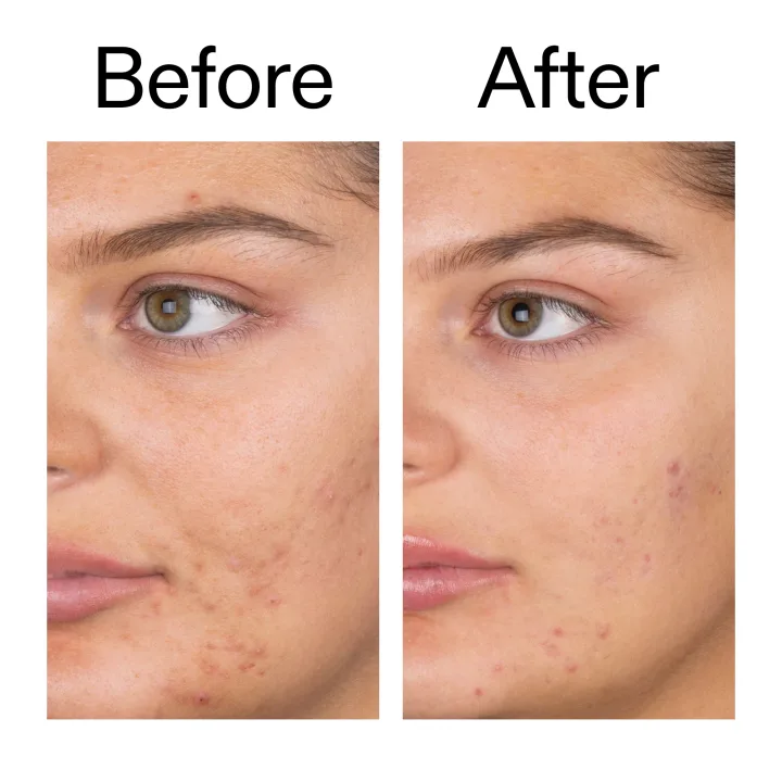 The Inkey List Salicylic Acid Cleanser 60 ml The Inkey List