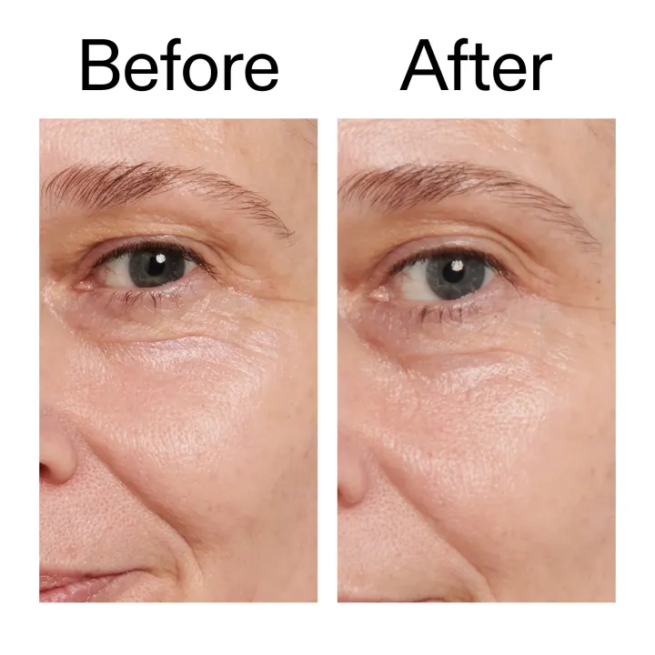 The Inkey List Retinol Eye Cream 15ml The Inkey List