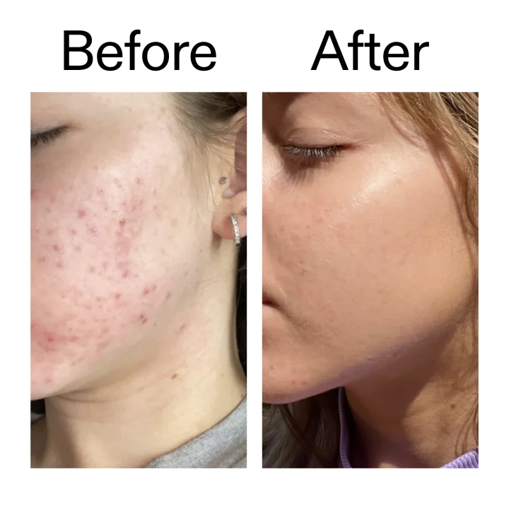 The Inkey List Niacinamide Serum 30ml The Inkey List
