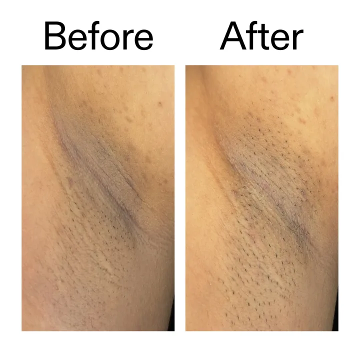The Inkey List Glycolic Acid Exfoliating Body Stick The Inkey List