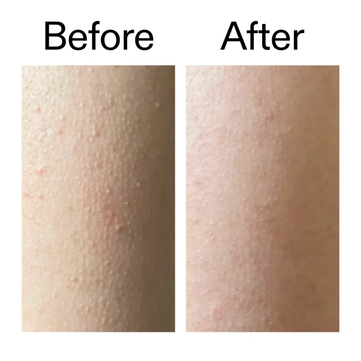 The Inkey List Glycolic Acid Exfoliating Body Stick The Inkey List
