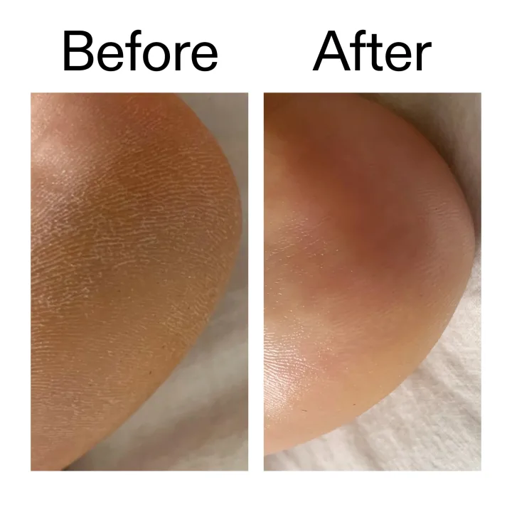 The Inkey List Glycolic Acid Exfoliating Body Stick The Inkey List