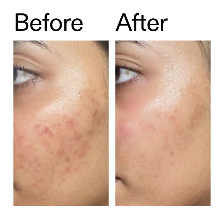 The Inkey List Ectoin Hydro-Barrier Serum 30 ml The Inkey List