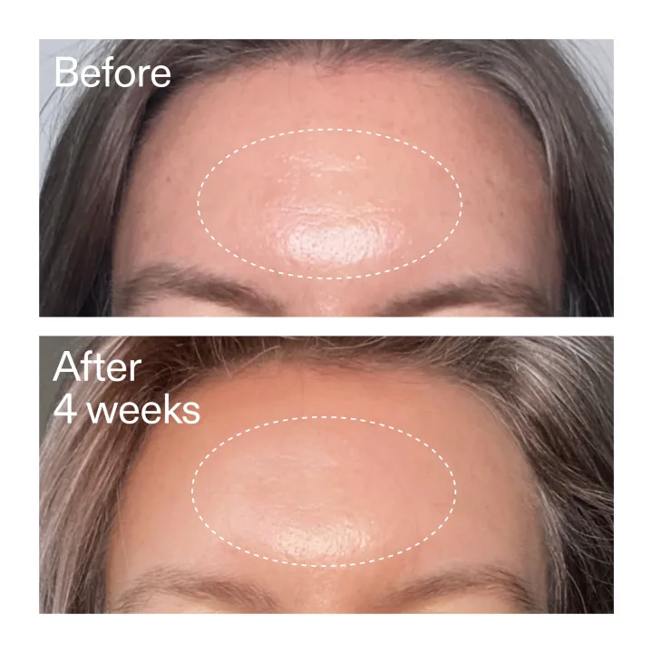 The Inkey List Advanced Retinal Serum 15 ml The Inkey List
