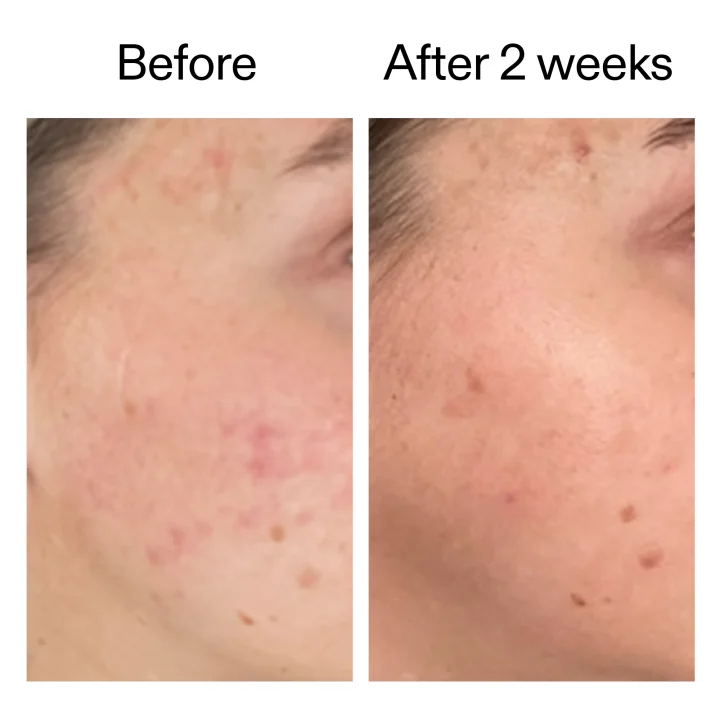 The Inkey List 360 Skin Clearing Serum 30 ml The Inkey List
