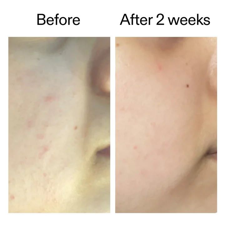 The Inkey List 360 Skin Clearing Serum 30 ml The Inkey List