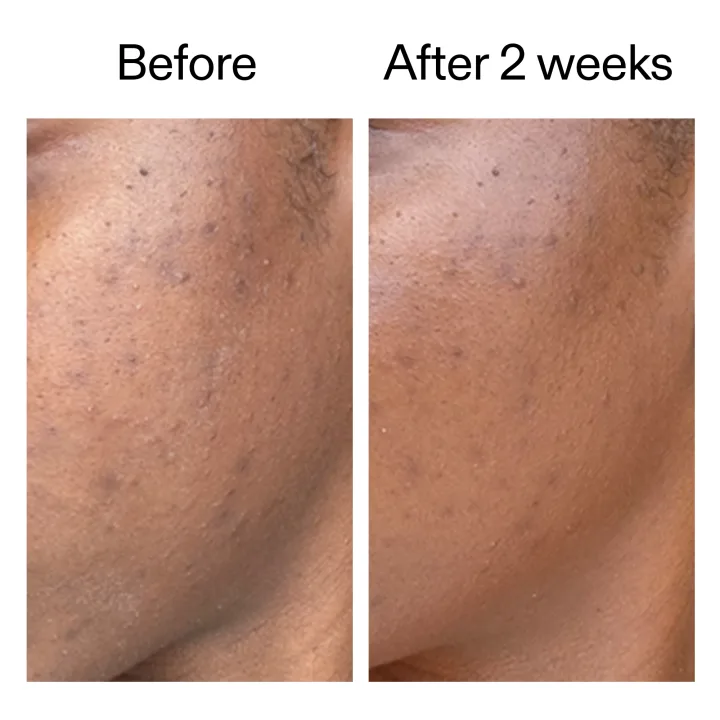 The Inkey List 360 Skin Clearing Serum 30 ml The Inkey List