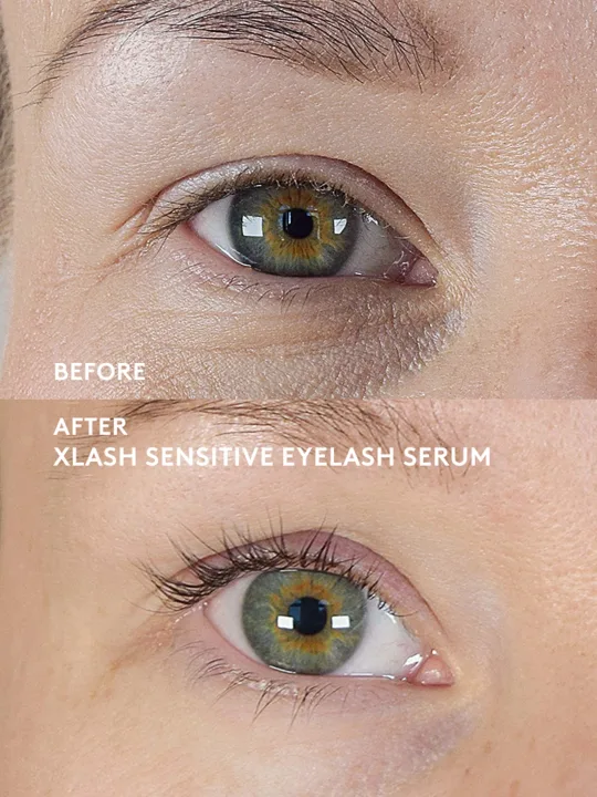 Xlash Sensitive Eyelash Serum 3 ml Xlash